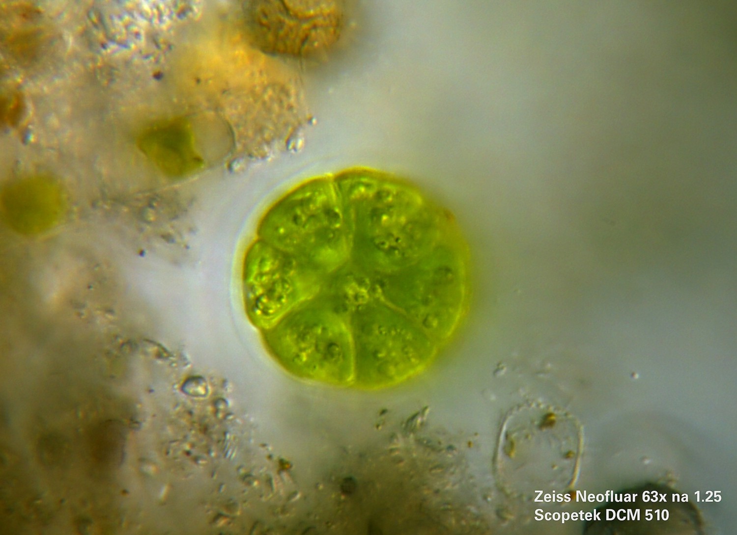 Pediastrum?